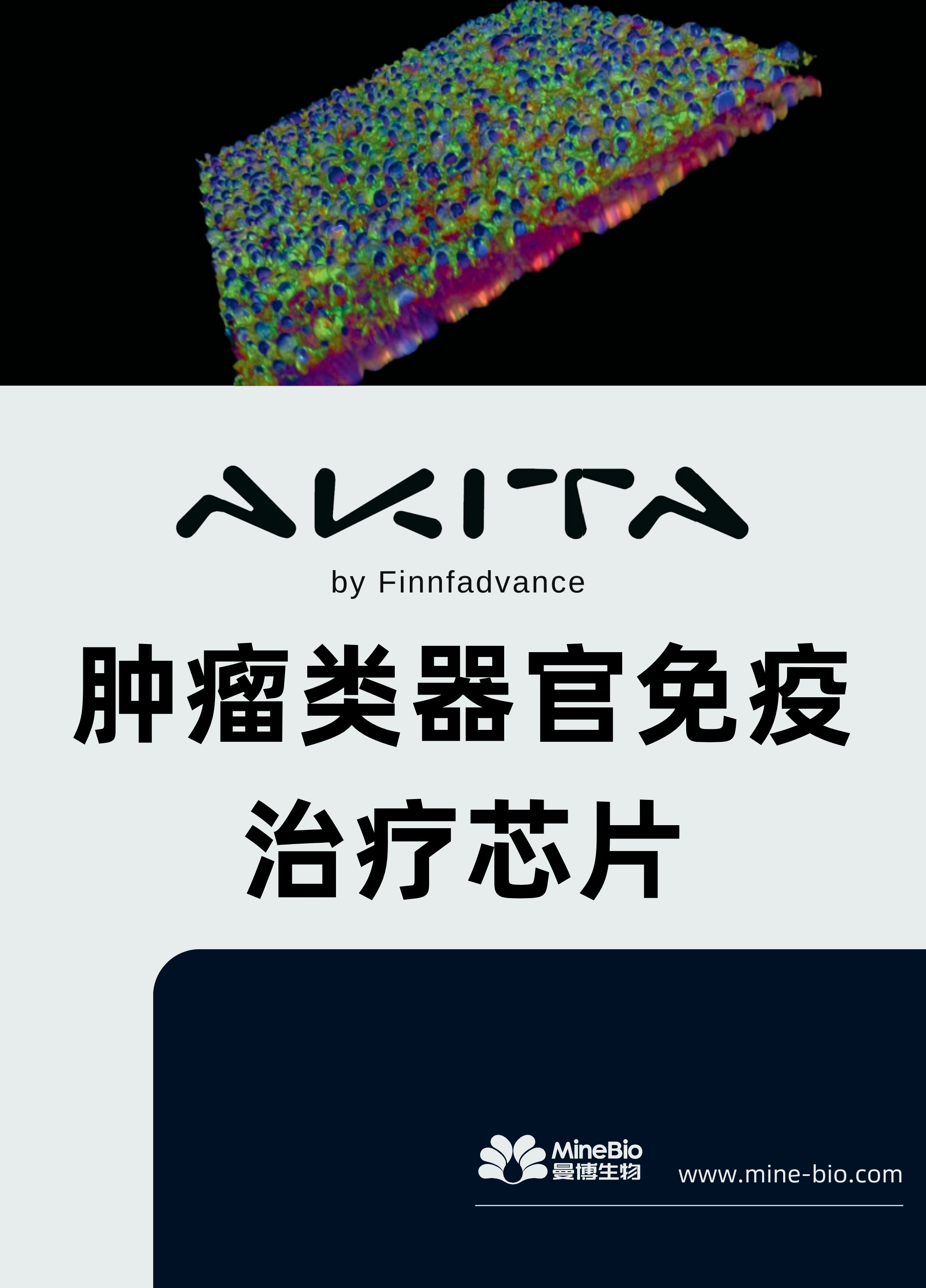 肿瘤类器官免疫治疗芯片