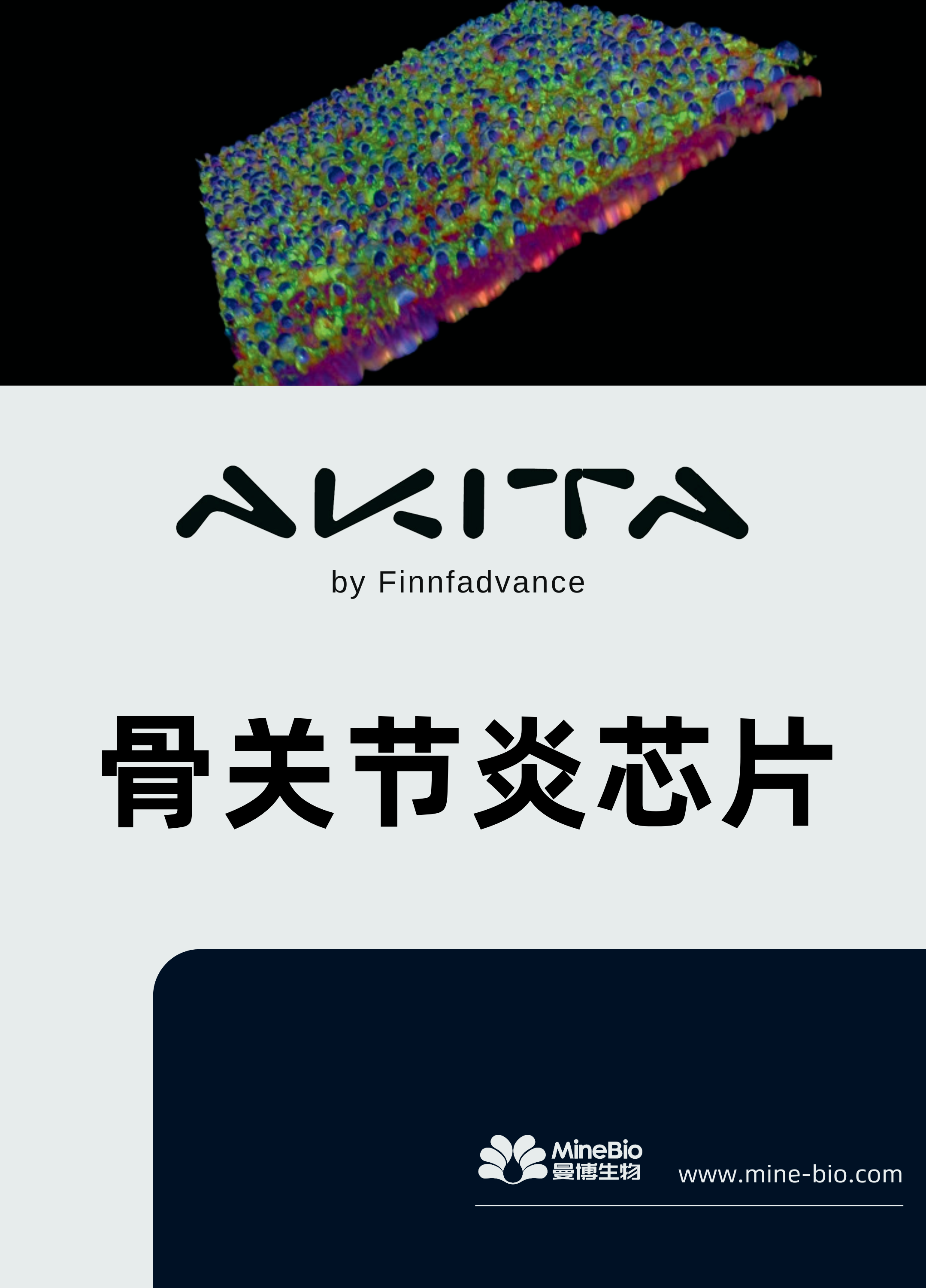 骨关节炎芯片