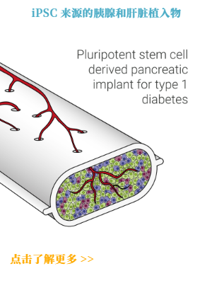 iPSC 来源的胰腺和肝脏植入物
