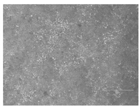 球状体分离传代前的成熟阶段