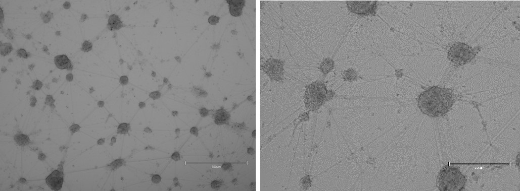 第35天分化成熟的多巴胺能神经元