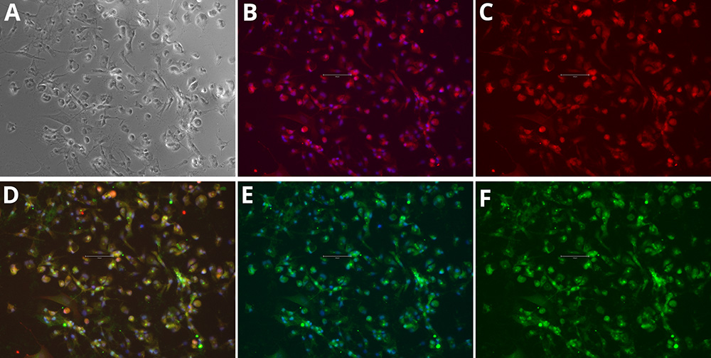 分化 iPSC 中小胶质细胞标志物的免疫细胞化学分析