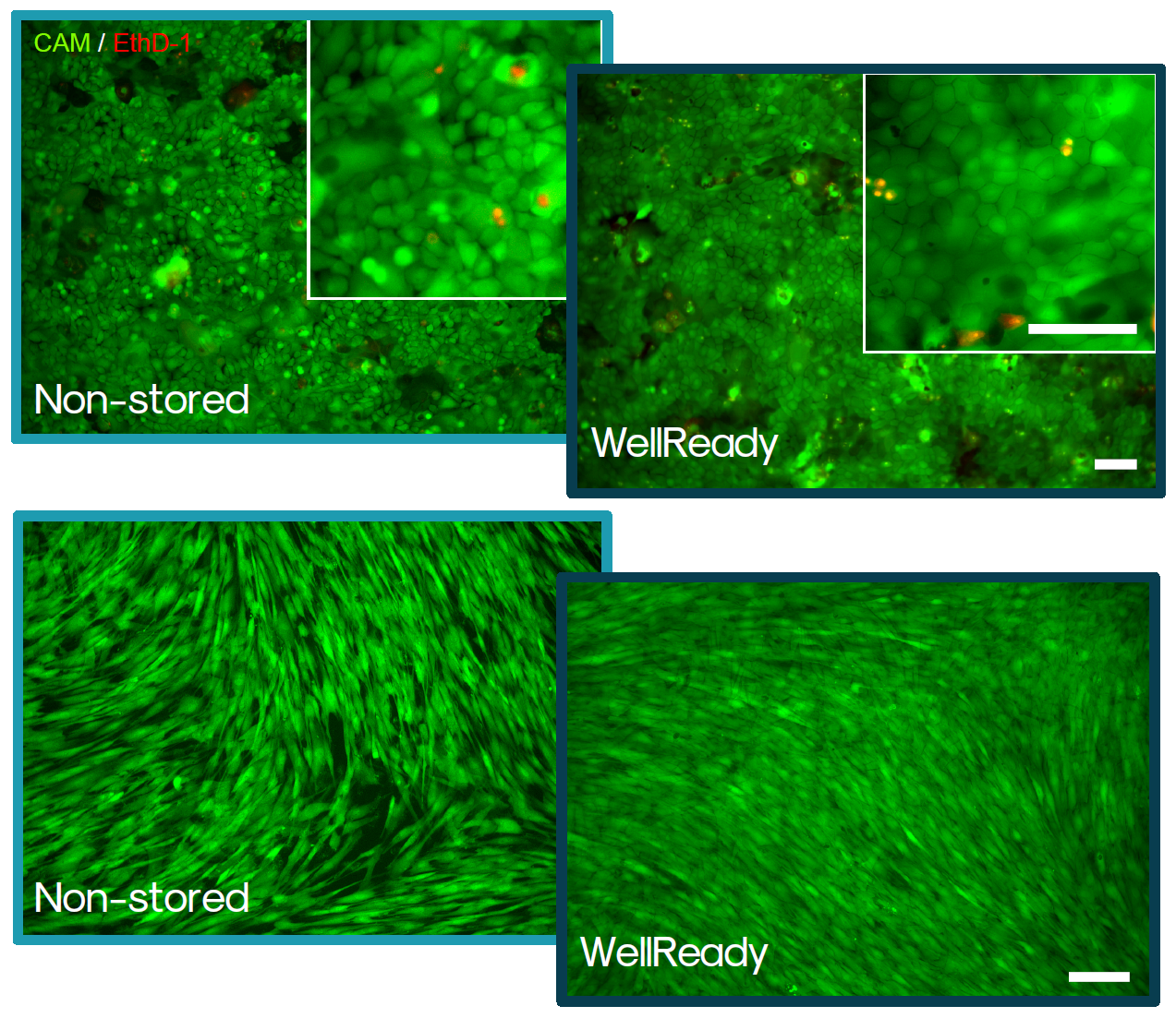 通过钙黄绿素 - AM/乙锭同源二聚体-1 染色法对真皮角质形成细胞(上)和真皮成纤维细胞(下)在储存5天前后的活/死细胞染色情况 通过钙黄绿素 - AM/乙锭同源二聚体-1 染色法对真皮角质形成细胞(上)和真皮成纤维细胞(下)在储存5天前后的活/死细胞染色情况