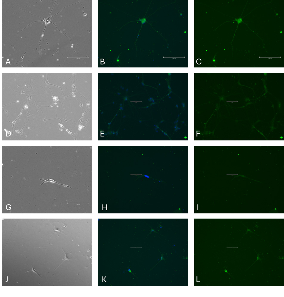 分化型iPSC中星形胶质细胞标记物的免疫细胞化学染色 分化型iPSC中星形胶质细胞标记物的免疫细胞化学染色