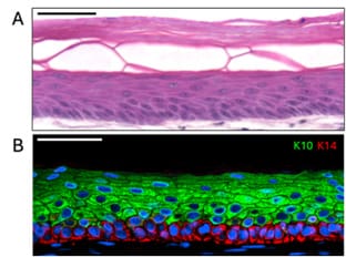 Qkine的KGF促进角质形成细胞分层与分化
