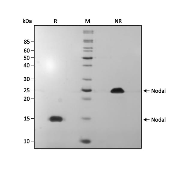 SDS-PAGE电泳分离纯度验证 SDS-PAGE电泳分离纯度验证
