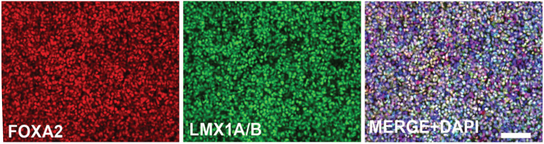 LN111上培养的hESC-DA的FOXA2和LMX1A/B的免疫荧光染色（比例尺为100μm）