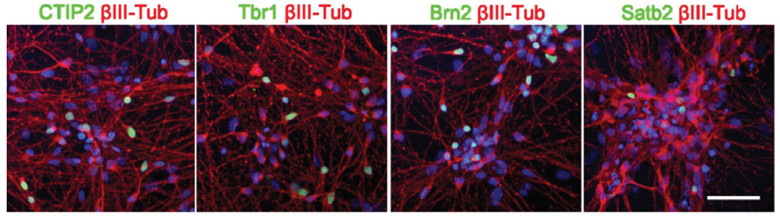 对Biolaminin上培养分化得到的皮质特异性神经元进行免疫荧光染色检测早期后后期标志物