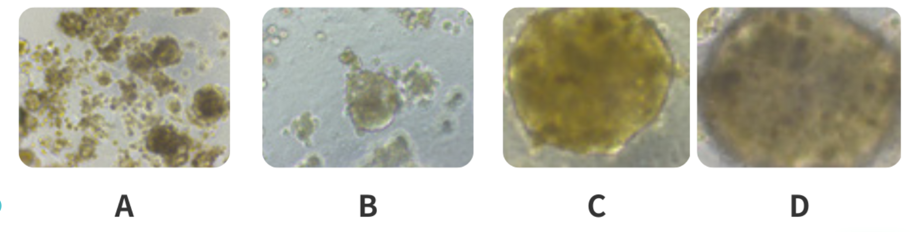 肝球体形成的图像