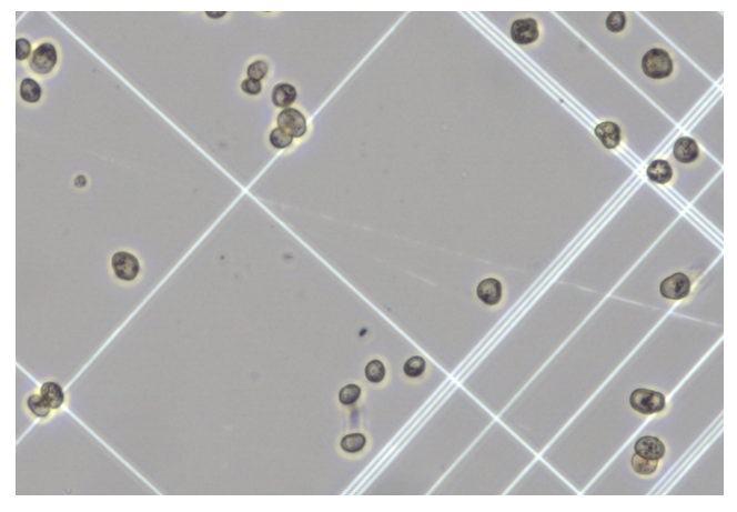 图3. 成人原代肝细胞，复苏后（明场）