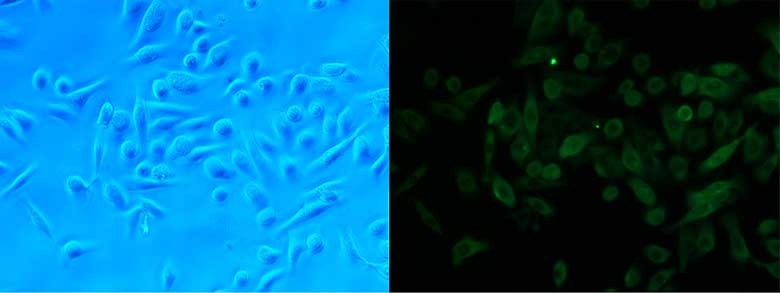 图2.Epithelix肺泡ATI细胞表征。左图：相差显微镜图像。右图：Aquaporin 5（ATI，肺泡1型细胞）阳性。