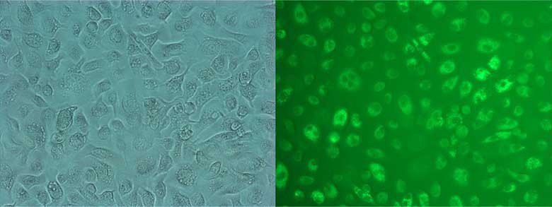 图3：Epithelix肺泡ATII细胞表征。左图：相差显微镜图像。右图：LysoTracker Green DND-26（ATII，肺泡细胞2型）阳性。