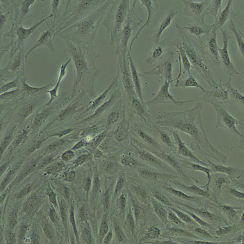 图2.人肝星状细胞（Hepatic Stellate Cells, HSCs）