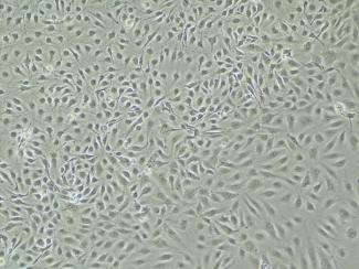 图3.肝窦内皮细胞（Liver Sinusoidal Endothelial Cells, LSECs）