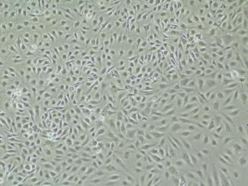 肝窦内皮细胞（Liver Endothelial Cells, LECs）